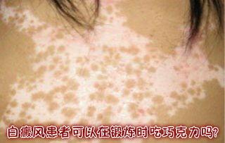 白癜风吃角瓜行吗,白癜风患者的天然食疗选择